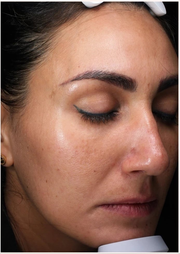 Growth Factor Induced Therapy™ after